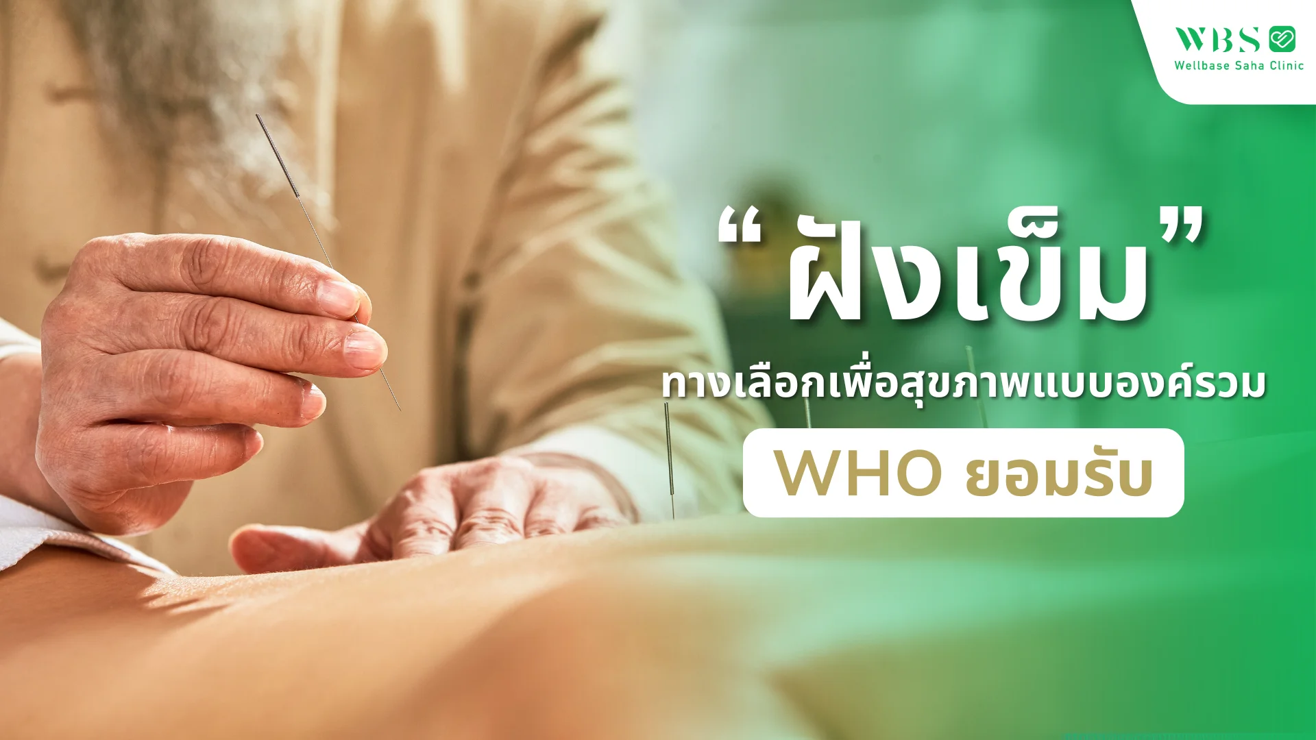 ‘ฝังเข็ม’ ทางเลือกเพื่อสุขภาพแบบองค์รวมที่ WHO ยอมรับ