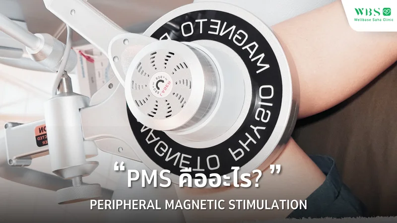 PMS คืออะไร? และกลไกการทำงานเป็นอย่างไร?