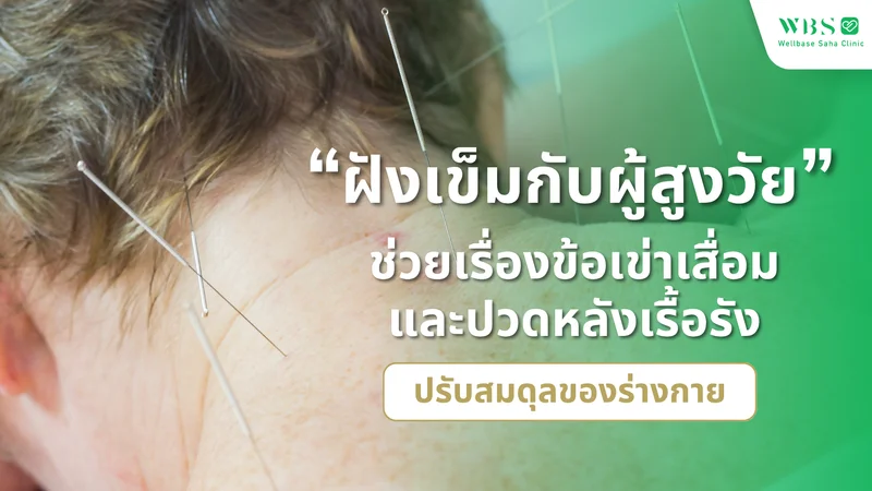 “ฝังเข็มกับผู้สูงวัย” ช่วยเรื่องข้อเข่าเสื่อมและปวดหลังเรื้อรัง