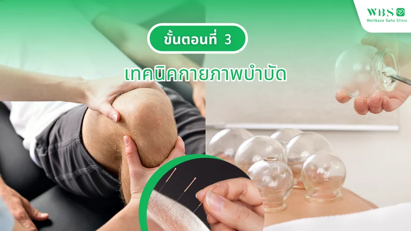 ขั้นตอนที่ 3 เทคนิคกายภาพบำบัด